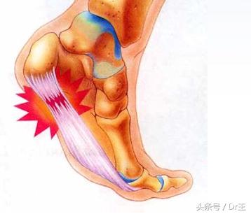 足部疼痛您都了解吗,足部反射区疼痛原因