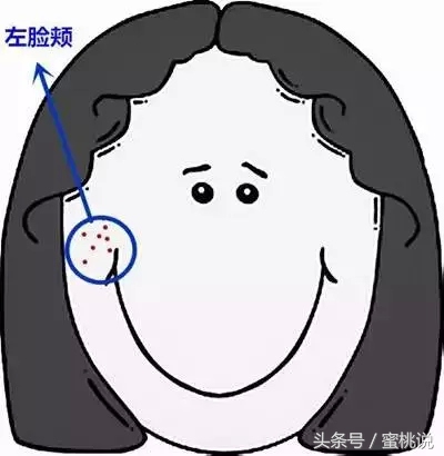 12岁脸上长痘按什么穴位,各个部位长痘原因太阳穴