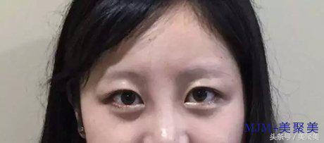 刚做完眉毛怎么那么黑,刚做完的眉毛很黑很浓怎么办