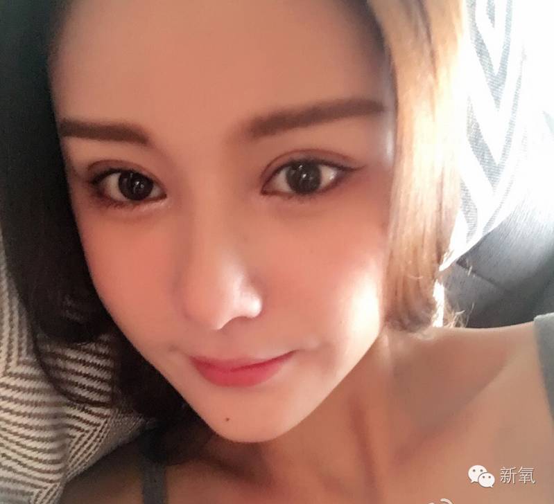 网红做双眼皮变化,整双眼皮成功的网红