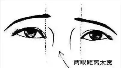 开内眼角和外眼角哪个好看,外眼角上扬适合开外眼角吗