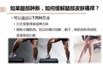 林志淼治掌跖角化症,腿上银屑病怎么治