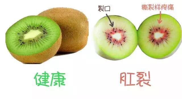 女性生了孩子得痔疮,生产后痔疮会自愈吗