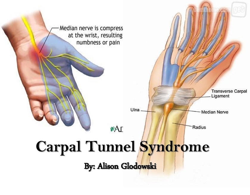 骑车久手发麻,骑车久了手麻怎么办呢