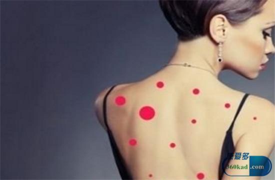 身体容易生疮是什么病的前兆,一年四季身上都长疮是什么疮