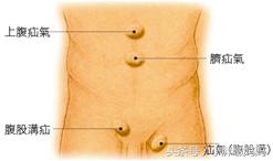 怎么判断宝宝疝气要不要手术,怎么判断宝宝有没有得疝气