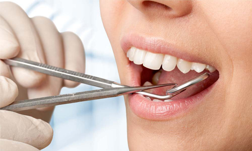 反复口腔溃疡，这种中药漱口，通常3天即愈