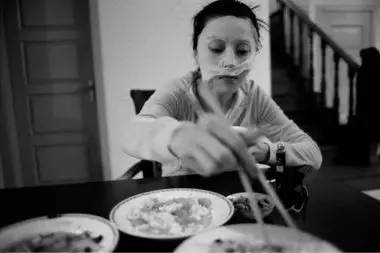 皮肤颗粒感很强很粗糙是什么原因,皮肤粗糙发黑是什么原因引起的