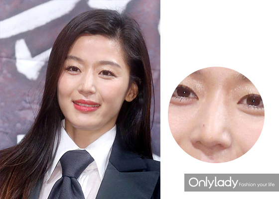 女子花4万块整容把嘴都整歪了,美国女子花76万整容