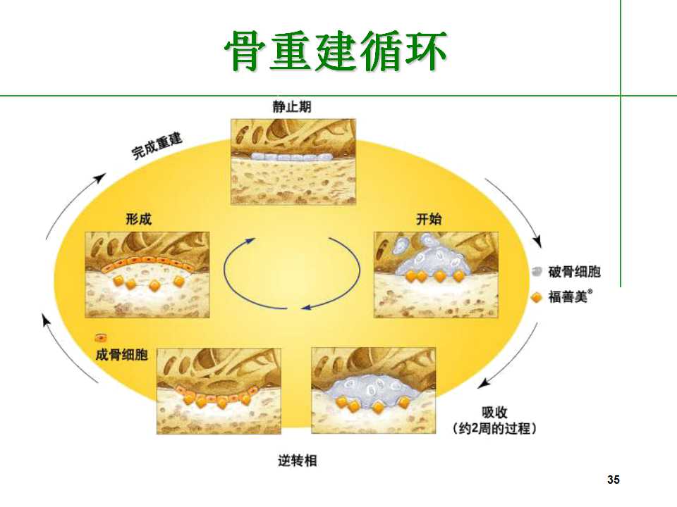 人到中年后骨质疏松要怎么治,中老年人骨质疏松该怎么办