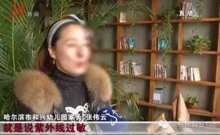 紫外线消毒烧伤幼儿眼睛怎么办,孩子紫外线晒伤皮肤发红怎么办