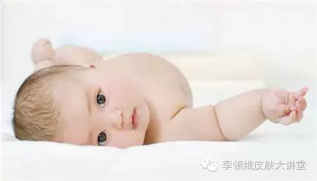 婴幼儿血管瘤敷滴眼液,婴幼儿面部血管瘤专家