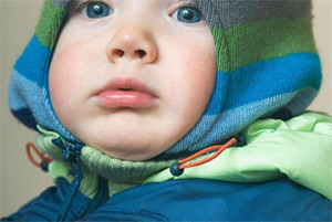 宝宝湿疹如何正确护理,宝宝湿疹怎么照顾