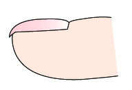 指甲出现白点、纵纹是怎么回事?