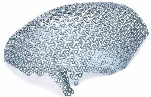 3d打印技术助骨科精准手术,3d打印技术在骨科的应用