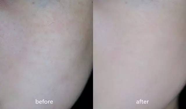 干皮秋冬最好用的24小时粉底液,怎么选择一款适合混干皮的粉底液