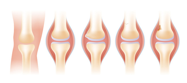 你的骨头够硬吗,你的骨头还好吗