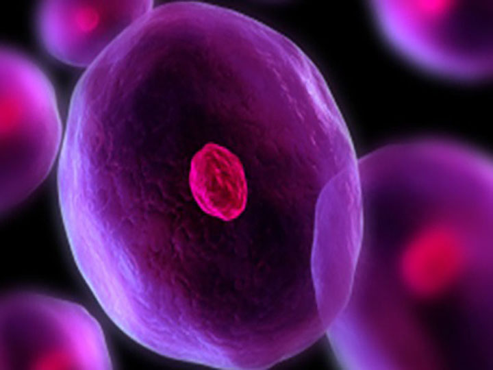 癌症转移和复发的区别,什么是癌转移