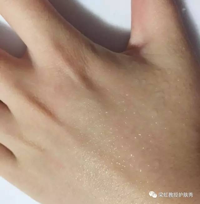 梁虹医疗美容,梁虹医美护肤品