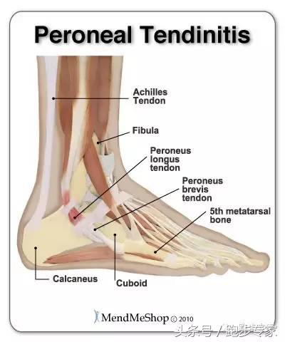 脚踝疼痛做什么检查比较准确,脚踝疼痛自查方法