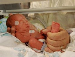 2.4斤早产儿后遗症概率,2.7斤早产儿养的活吗