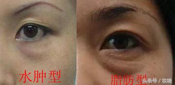 平价去黑眼圈消肿眼霜测评红黑榜 (黑眼圈眼霜推荐真实有用)