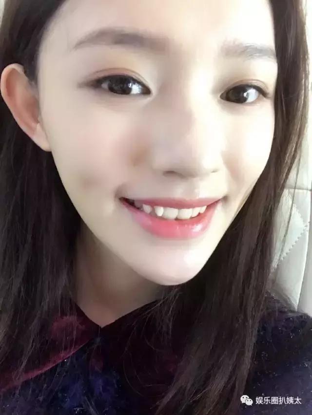 林允因换牙变脸?徐娇从假小子变小女人?星女郎现在都怎么样了?