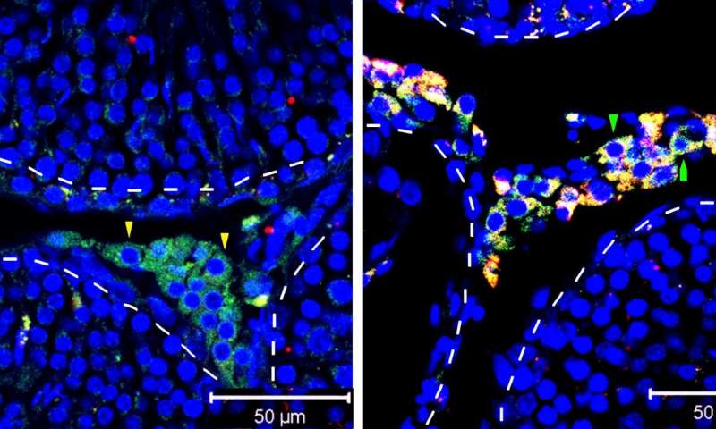 治疗睾酮低的最好手段,睾酮素水平下降怎么办