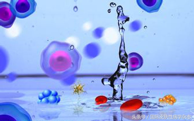 移植物抗宿主病是什么意思 (输血相关性移植物抗宿主病)