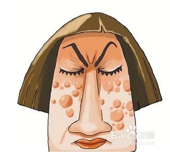 怎么治满脸痘痘,教你脸上长痘怎么快速消除小妙招