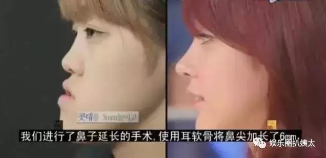 泰国专门的整容节目,泰国的整容节目有哪些