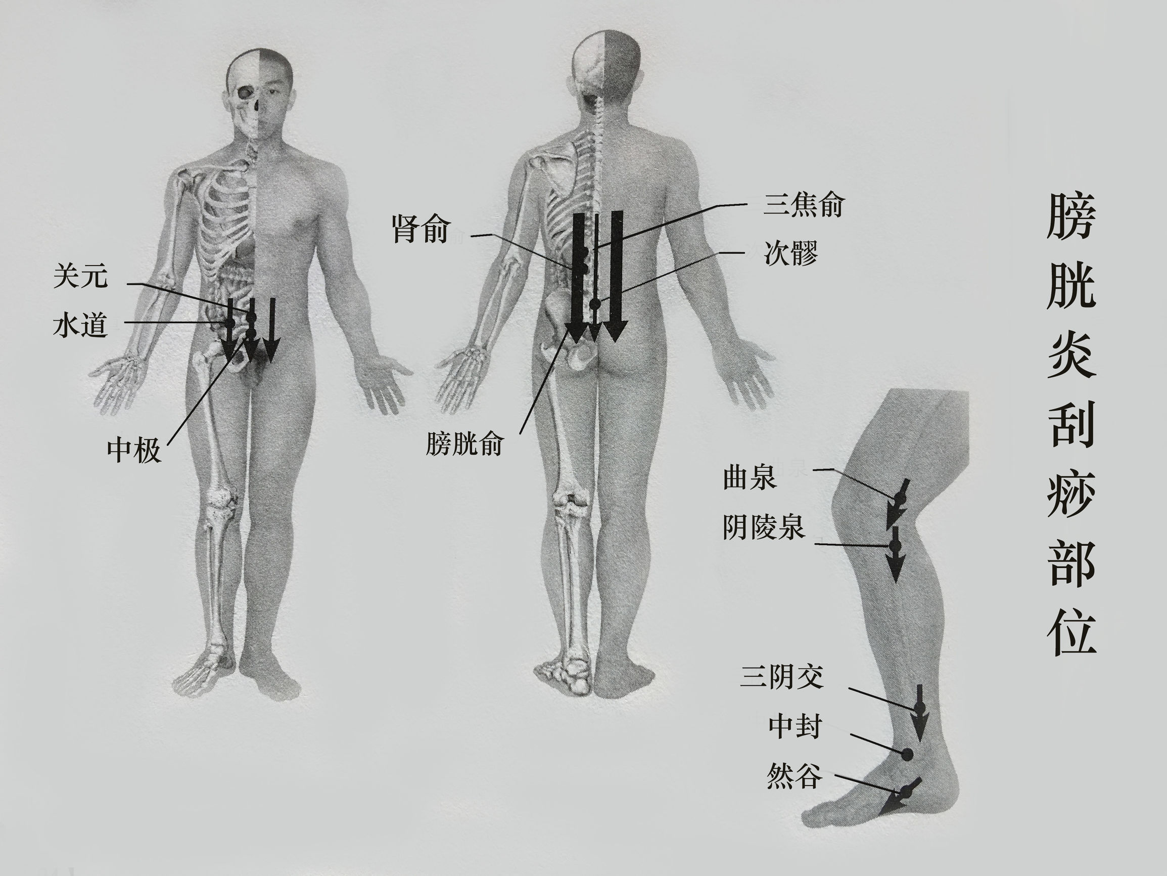 尿道炎的艾灸治疗,尿道炎刮痧