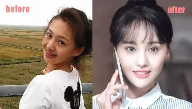 整牙=整容?看杨幂、刘涛、高圆圆为你亲身示范!