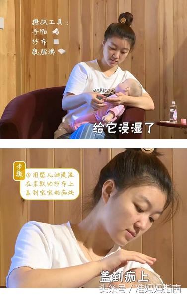 奶痂怎么去除最快方法,婴儿奶痂怎么才能去掉