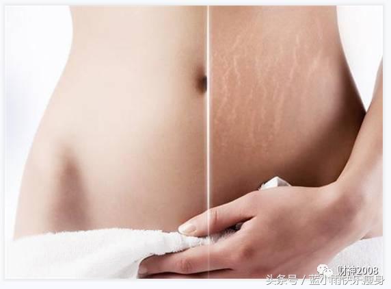 快速减肥导致橘皮纹,快速减肥后皮肤松弛了怎么办