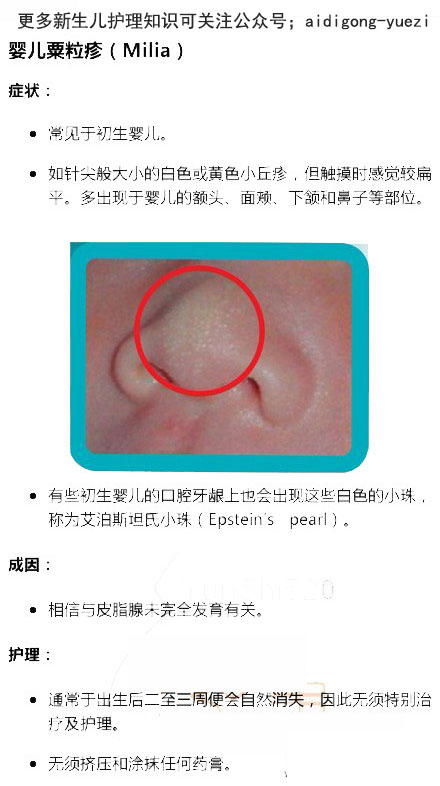 湿疹or热痱，傻傻分不清!八种宝宝常见皮肤问题及护理指南