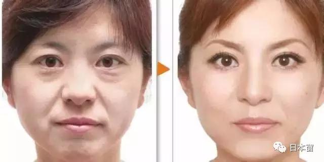 美容院用的胎盘素紧致精华液,美容院专用面部补水保湿按摩膏