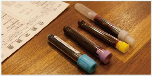 抽血化验的话可以喝水吗,抽血化验前可以喝水吗