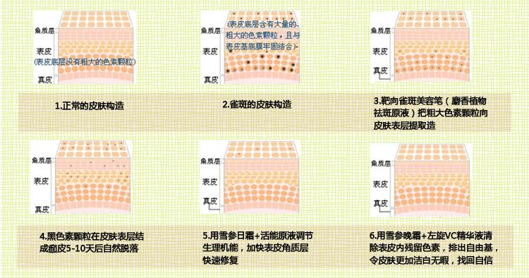 雀斑的治疗误区有哪些呢,雀斑治疗误区