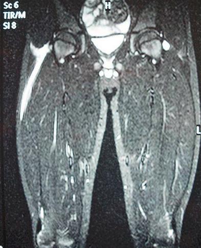 女性熬夜引发的病症,女性熬夜造成疾病