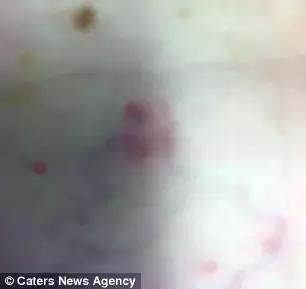 澳洲大蜘蛛咬人死亡,澳大利亚被蜘蛛咬死