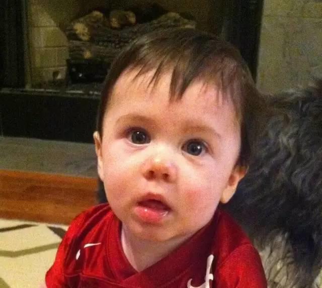 关于法令纹的种种误解,法令纹出现不要怕选对方法很重要