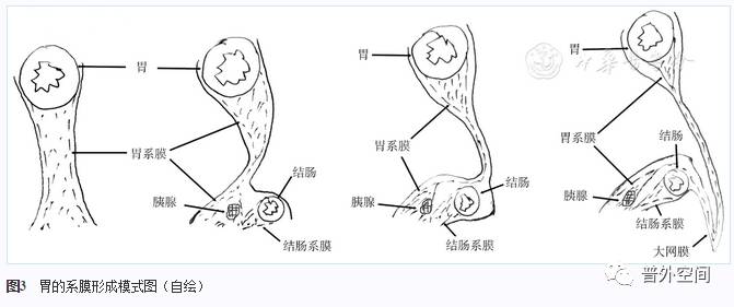 全胃切除是胃癌根治术吗,胃全切可以治愈胃癌吗