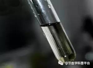 看尿液颜色判断身体有多少水,通过尿液颜色也能辨健康