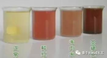 儿童怎么样避免伤害到肾,儿童医院专家教你如何保护孩子