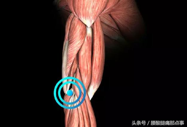 冲击波刺透疗法对网球肘有用吗,冲击波治网球肘的过程