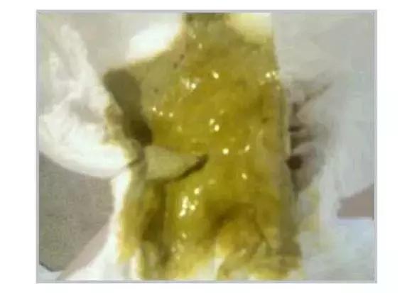 关于宝宝大便的11种性状,宝宝大便6种形状