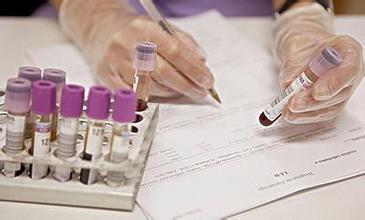 孕前检查能预防溶血吗,孕前验血可预防abo溶血