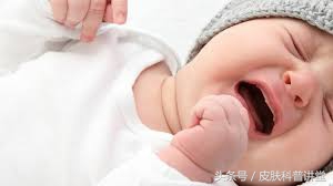 幼儿急疹的斑丘疹多久消失,幼儿急疹是否有痒的案例