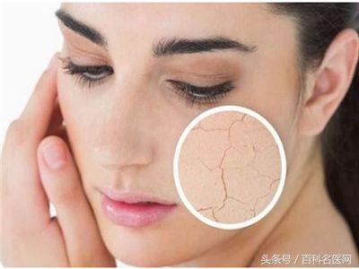 湿气会皮肤瘙痒,湿气会使毛孔发痒